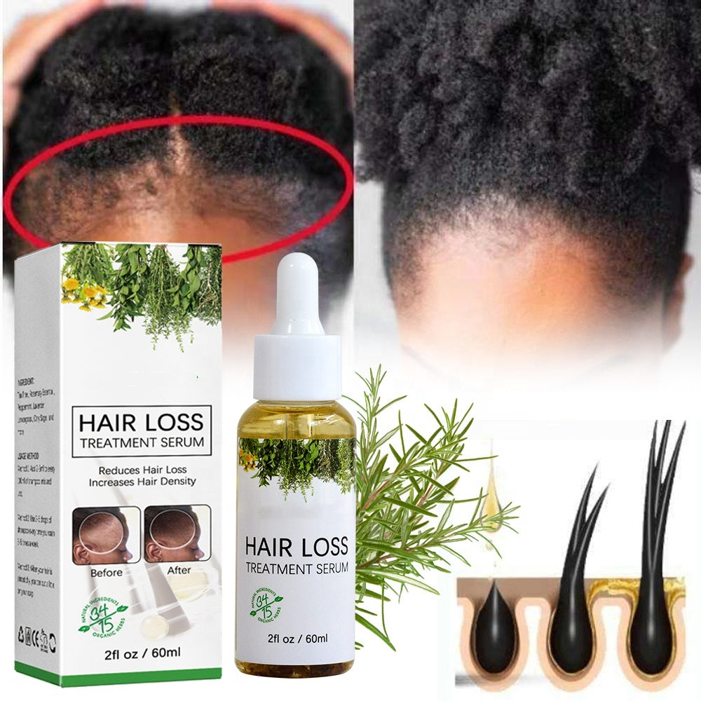 OEM Natural Hair Growth Oil Strengthening Promote Repair Damaged Reduce Splits Hair Loss Treatment Serum
