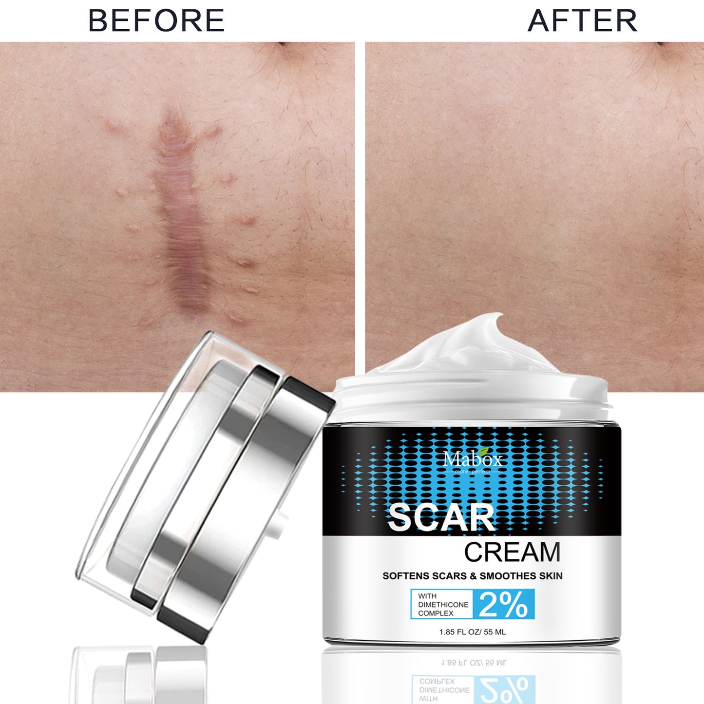 Hot Selling Smoothing Skin Moisturizer Repairing Soften Scar Cream
