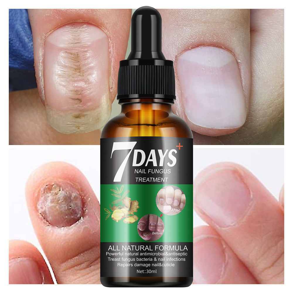 OEM Nutrient Repair Nourishing Cuticles Moisturizer Protecting Nail Essence Oil for Growth