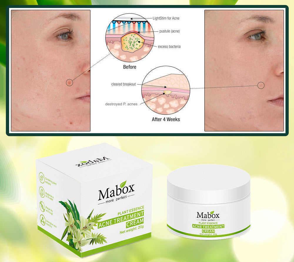 Skin Care Hyaluronic Acid Moisturiser Acne Treatment Cream For Teenager