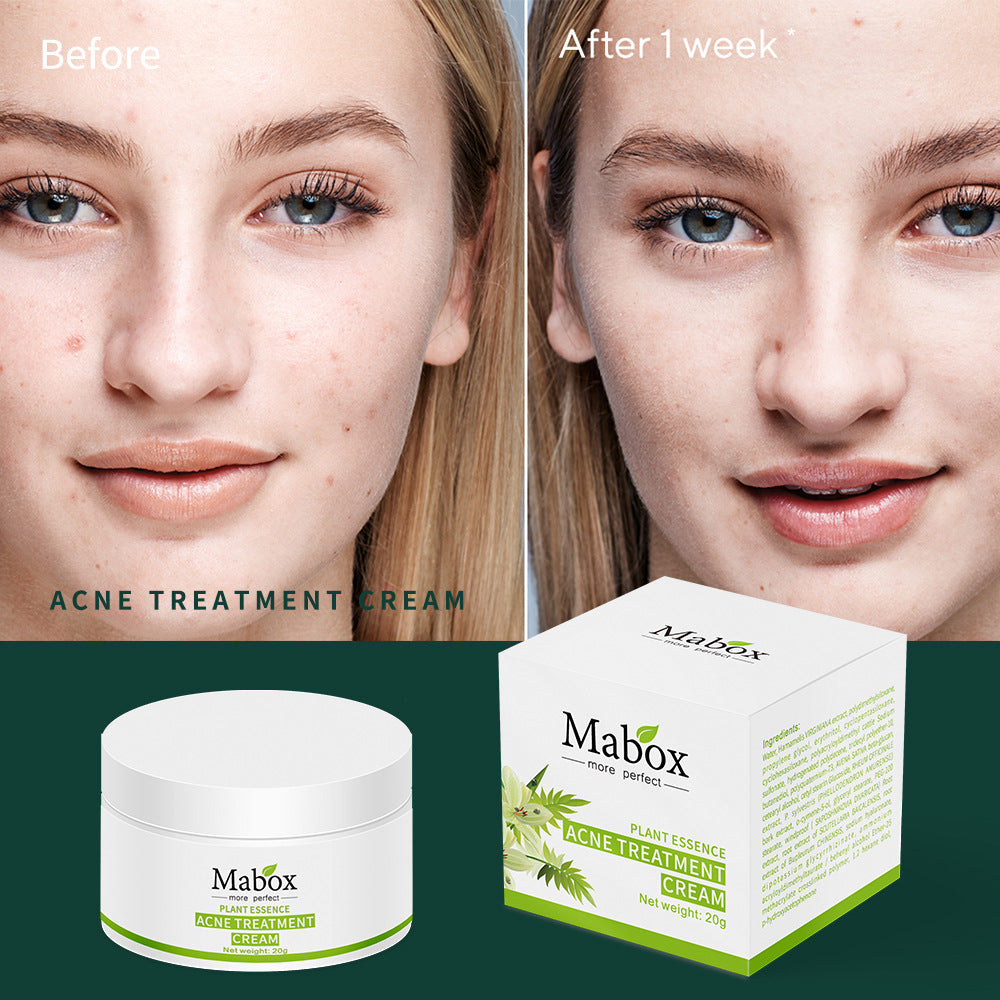Skin Care Hyaluronic Acid Moisturiser Acne Treatment Cream For Teenager