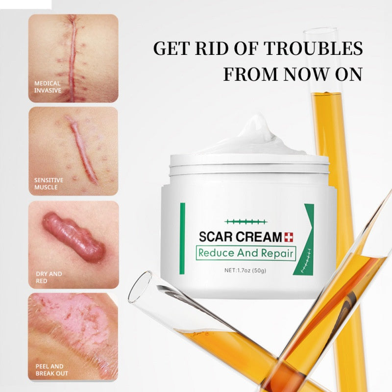 Effective Acne Scar Removal Cream Pimples Stretch Marks Remover Face Gel Supplier