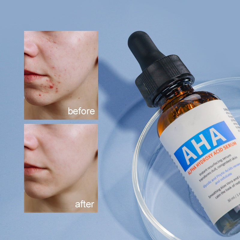OEM Pore Tightening Serum Smoothing Moisturizing Alpha Hydroxy Acid Serum for Oily Skin