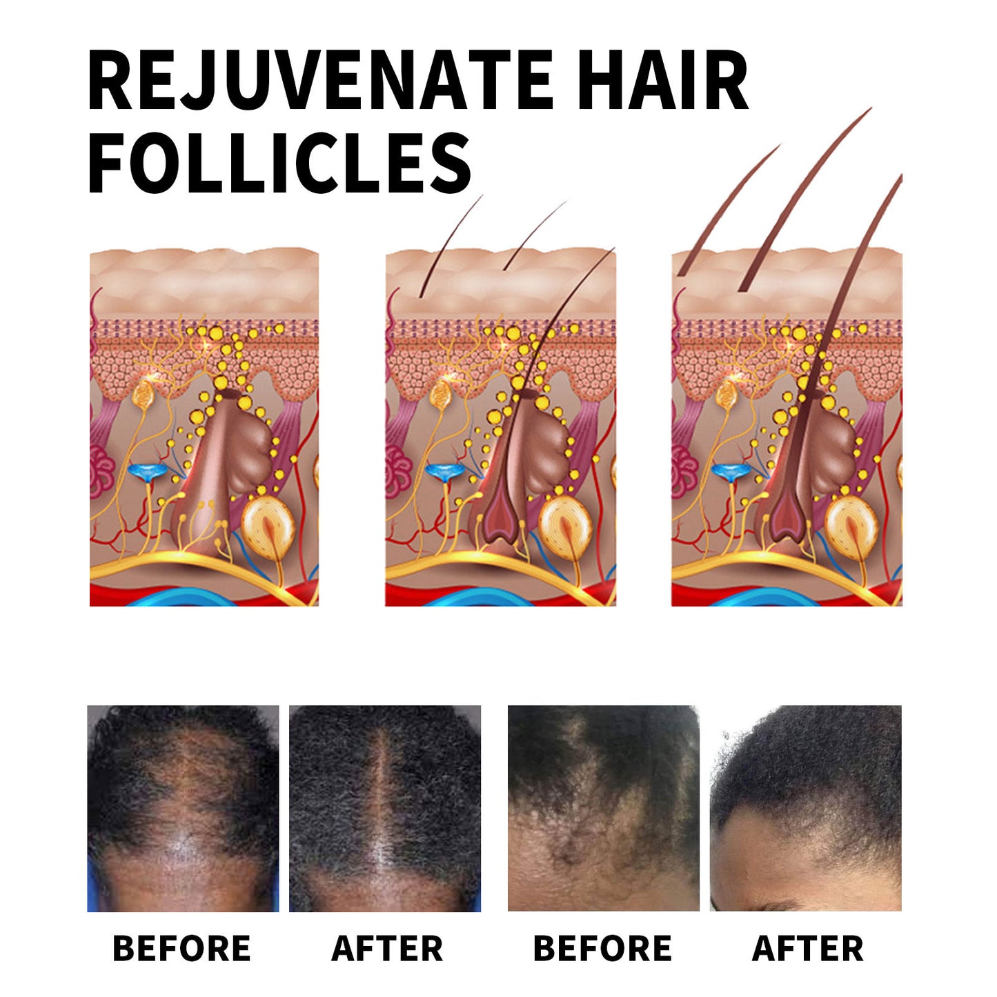 OEM Natural Hair Growth Oil Strengthening Promote Repair Damaged Reduce Splits Hair Loss Treatment Serum