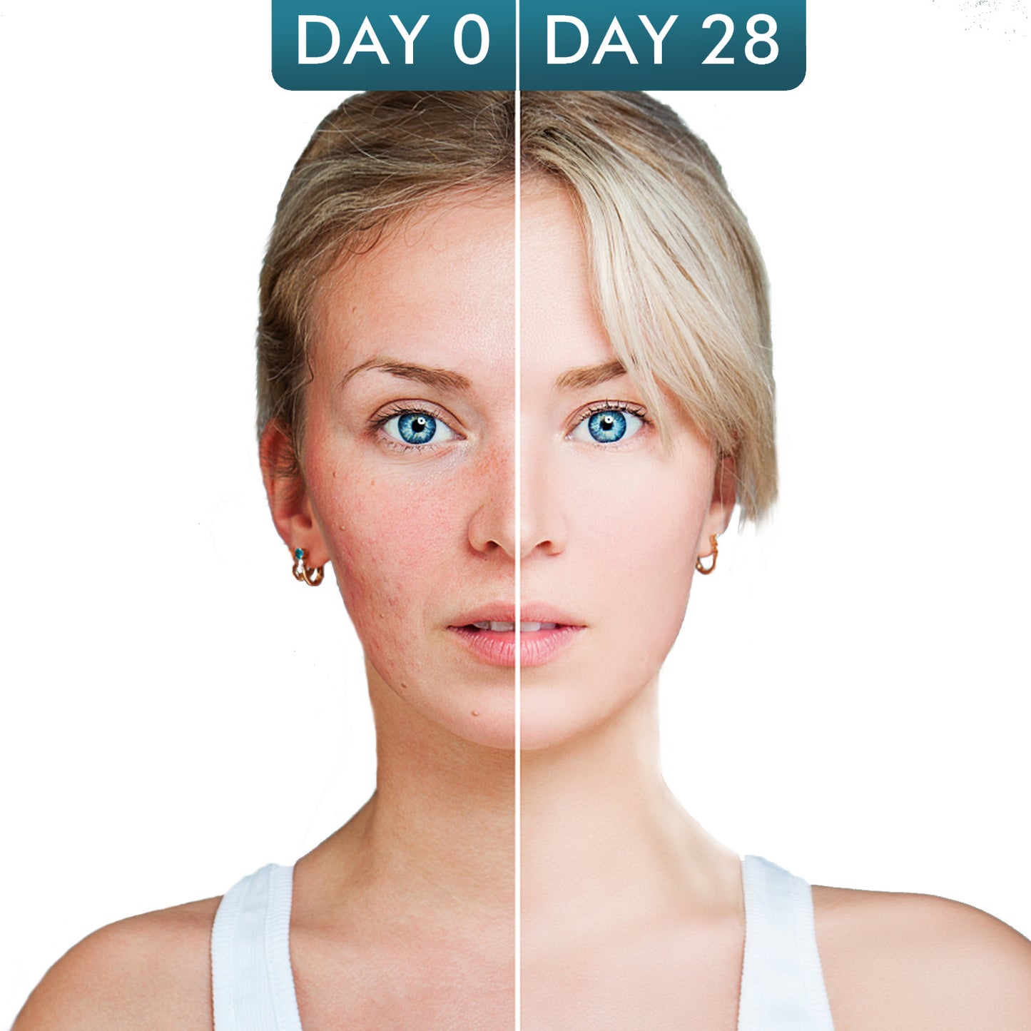 Best Retinol Skin Tightening Face Cream For Deep Wrinkles Sensitive Skin