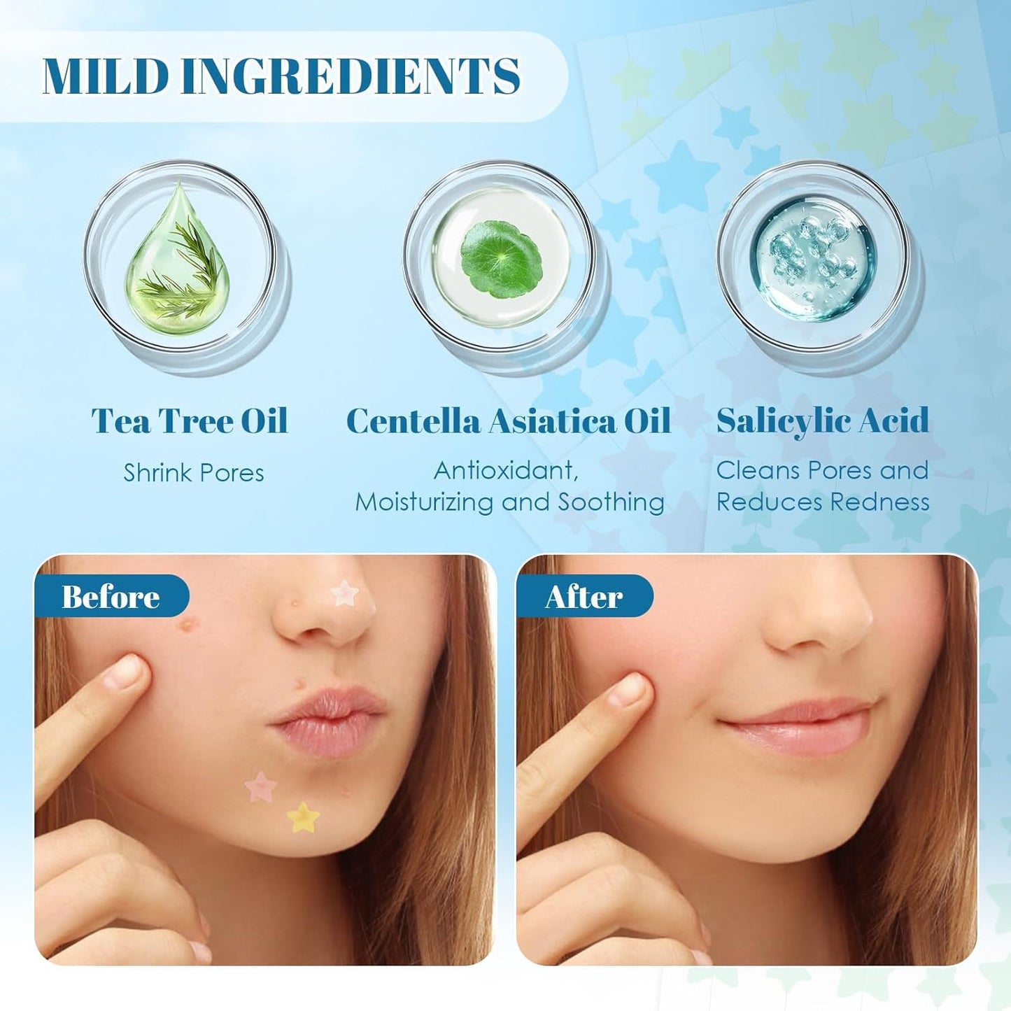 OEM Salicylic Acid Patch Colorful Acne Blemish Pimple Patches Acne Patch Sticker Supplier