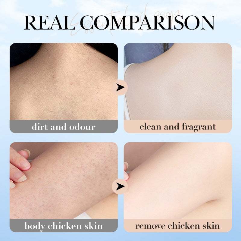OEM Remove Chicken Skin Sponge Soap Whitening Coconut Shea Butter Vitamin E Essence Oil Soap