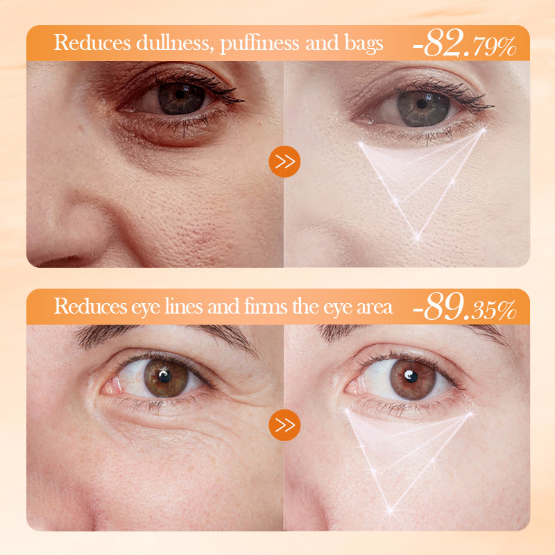 Wholesale Whitening Firming Recommended Vitamin C Eye Cream for Dark Circles