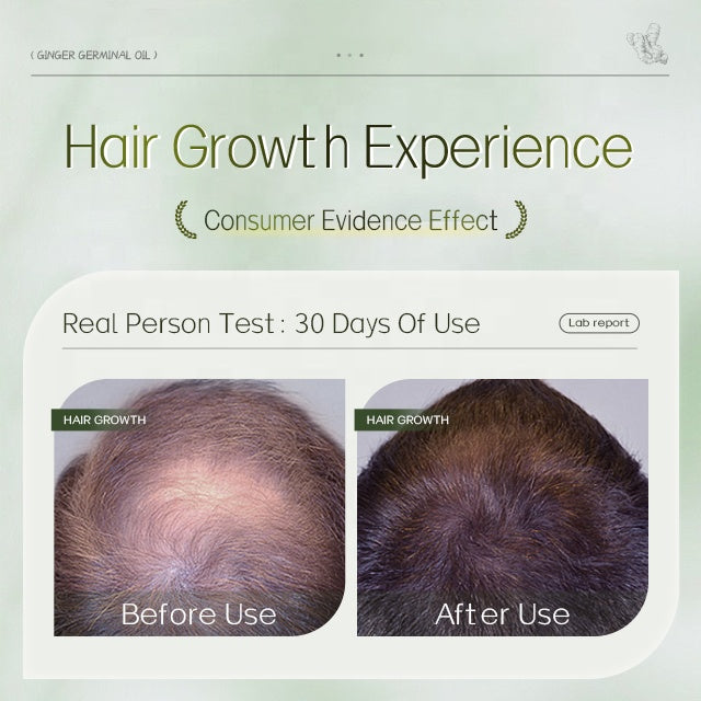 OEM Repairing Anti Loss Regrowth Scalp Elixirs Treatment Ginger Hair Oil for Hair Growth