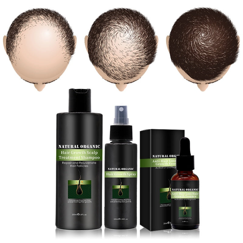 OEM Natural Organic Biotin Shampoo Smoothing conditioner Set for Hair Growth