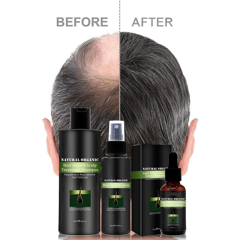 OEM Anti-Hair Loss Hair Growth Serum Soften Hair Styling Hydrating Beard Oil For Men