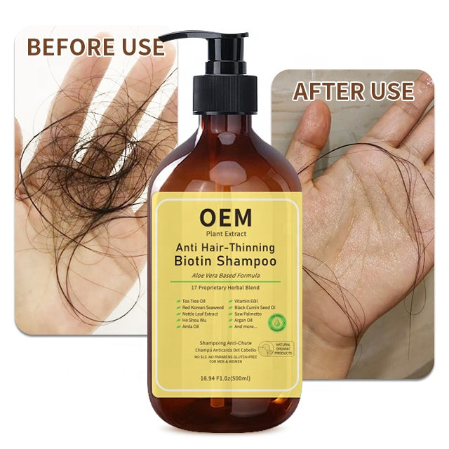 Customized Hair Growth Anti-hair Thinning Biotin Shampoo for Hair Loss