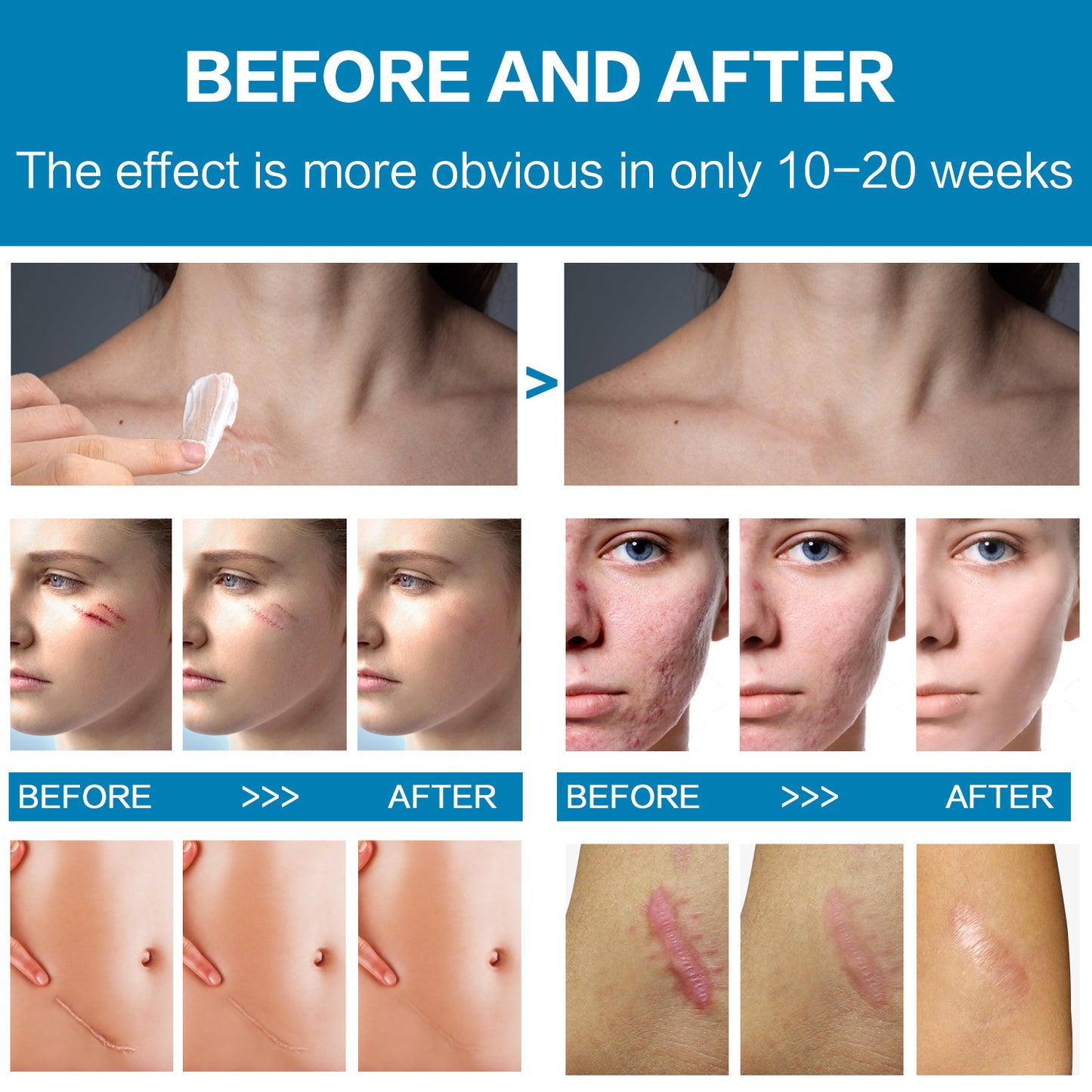 Hot Selling Smoothing Skin Moisturizer Repairing Soften Scar Cream