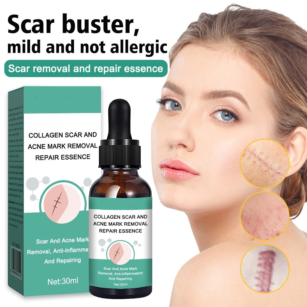 OEM Anti Inflammatory Collagen Scar and Acne Mark Removal Repair Essence Factory