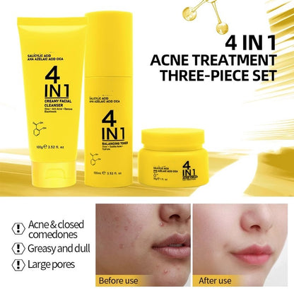 OEM Oil Control Salicylic Acid Facial Skin Care Set for Oily Skin, Reduces Acne, Blackheads & Blemishes