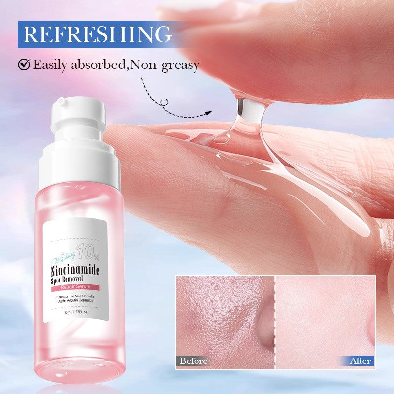 OEM Natural Niacinamide 10% Serum for Face, Spot Removal, Acne Treatment & Dark Spot Corrector