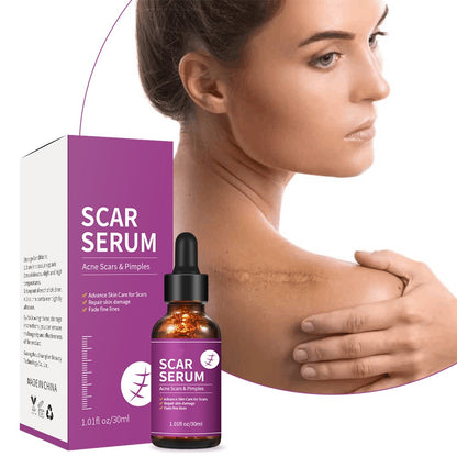 OEM Advanced Skin Care Scar Pimples Removal Serum, Treatment for Acne Scars, Stretch Marks, and Dark Spots