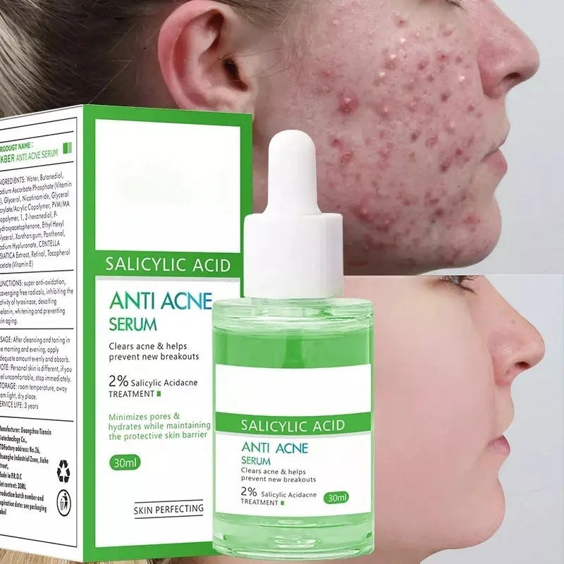 OEM Deep Cleans Pores Oil Control Salicylic Acid Serum for Acne Blackheads Supplier