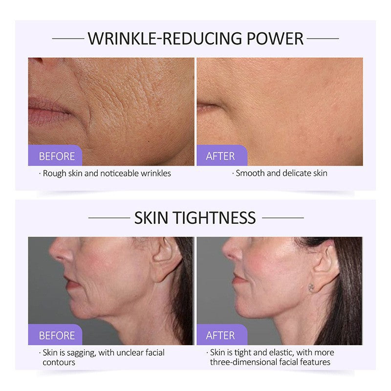 OEM Instant Lift Collagen Serum, Lifting and Reducing Wrinkles, Smoothing Fine Line