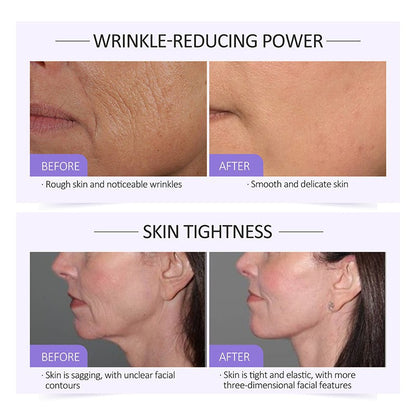 OEM Instant Lift Collagen Serum, Lifting and Reducing Wrinkles, Smoothing Fine Line