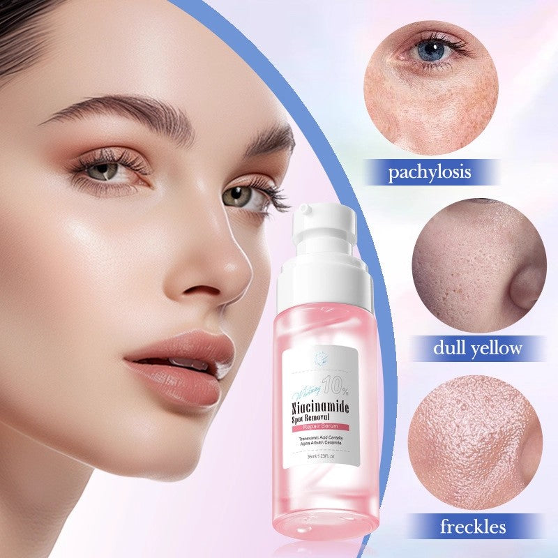 OEM Natural Niacinamide 10% Serum for Face, Spot Removal, Acne Treatment & Dark Spot Corrector