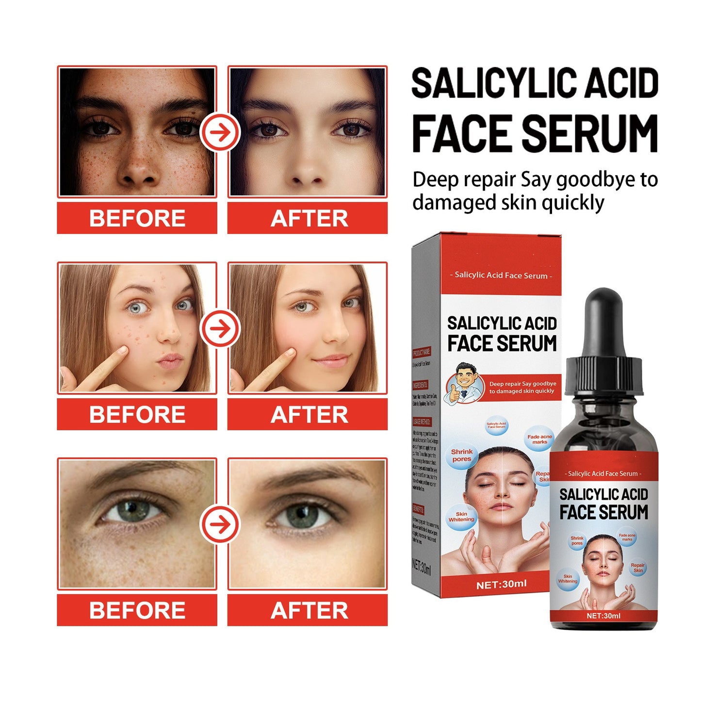 OEM Gentle Exfoliating Acne Spot Treatment Salicylic Acid Face Serum, Redness Relief