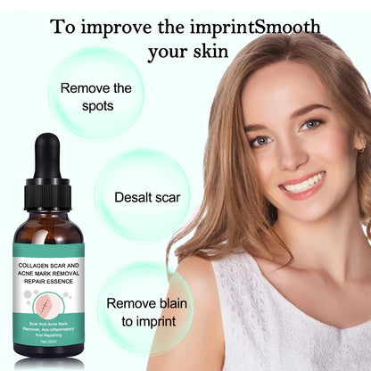 OEM Anti Inflammatory Collagen Scar and Acne Mark Removal Repair Essence Factory
