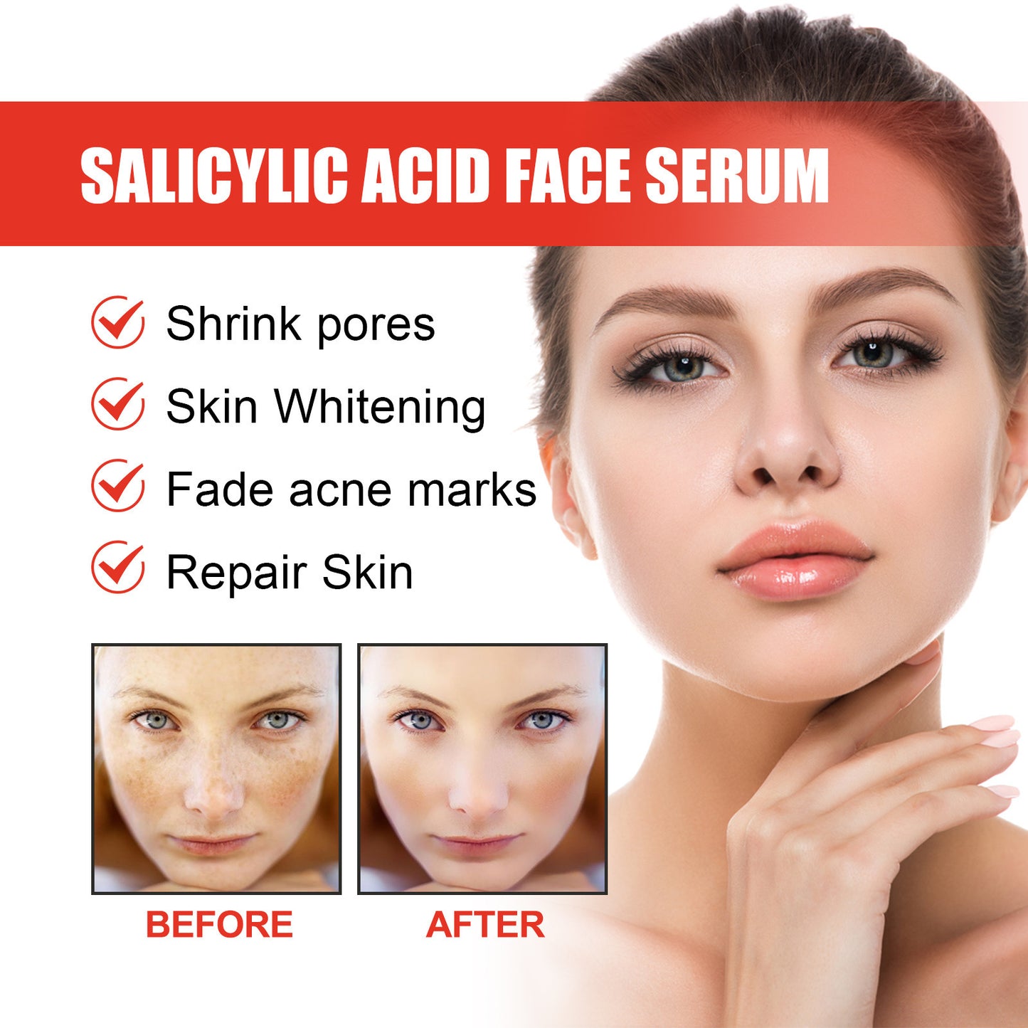 OEM Gentle Exfoliating Acne Spot Treatment Salicylic Acid Face Serum, Redness Relief