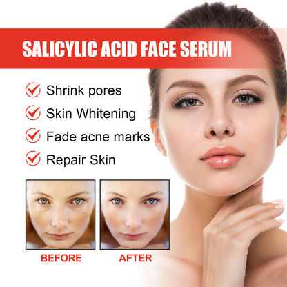 OEM Gentle Exfoliating Acne Spot Treatment Salicylic Acid Face Serum, Redness Relief