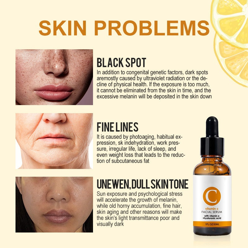 Wholesale Skin Care Vitamin C Serum with Vitamin E, Brightening Serum for Oily & Dry Skin