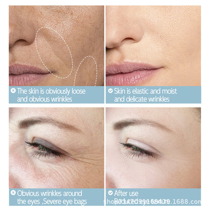 OEM Skin Care Whitening Nicotinamide Face Serum, Pore Minimizer, Even Skin Tone