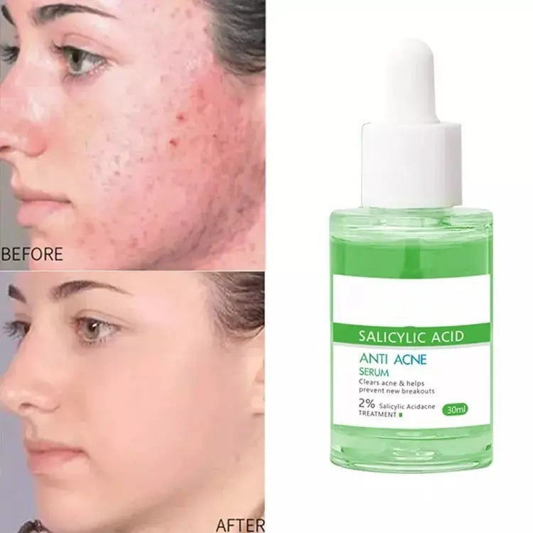 OEM Deep Cleans Pores Oil Control Salicylic Acid Serum for Acne Blackheads Supplier