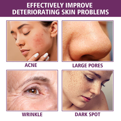 OEM Hydrating Anti-Aging Niacinamide 20% Face Serum for All Skin Type