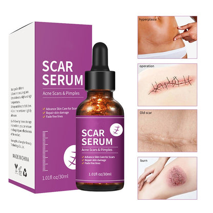 OEM Advanced Skin Care Scar Pimples Removal Serum, Treatment for Acne Scars, Stretch Marks, and Dark Spots