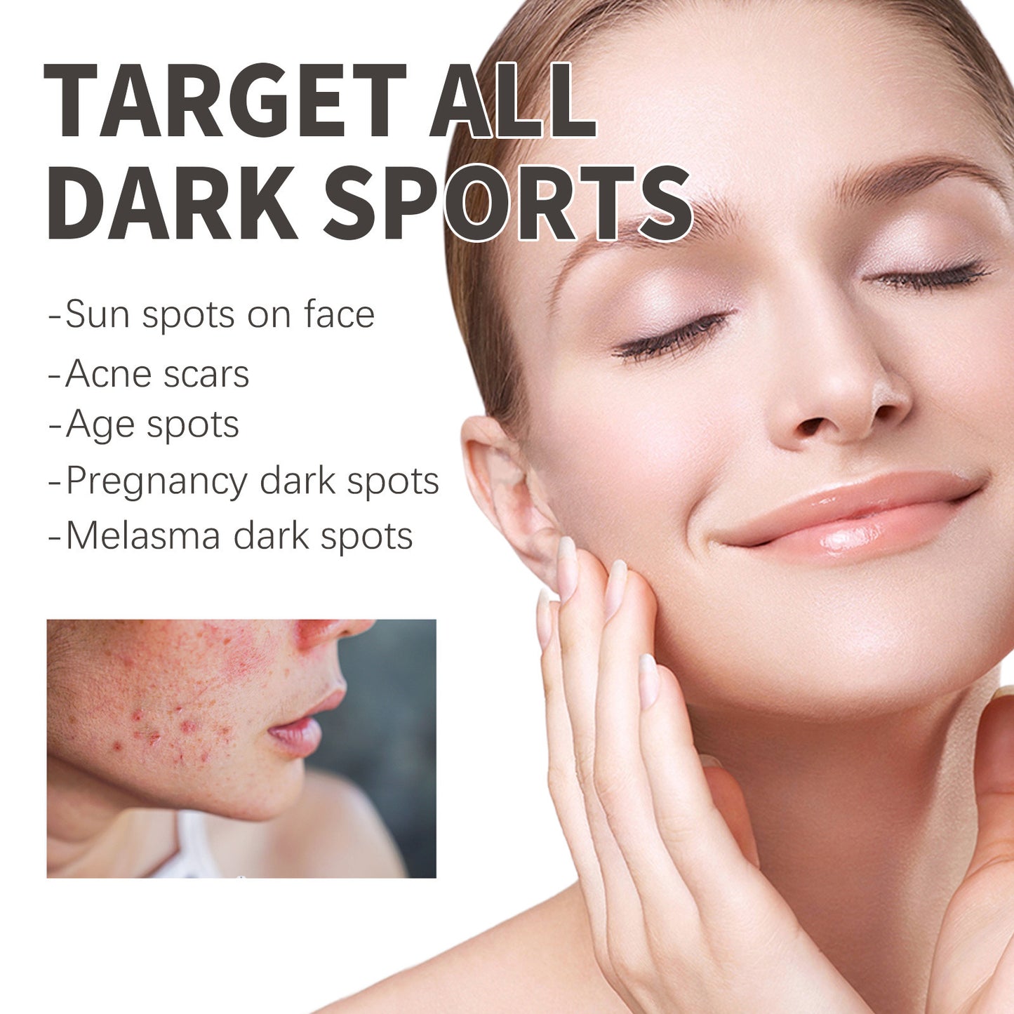 OEM Skin Care Dark Spot Remover Face Serum, Dark Spots Corrector Serum for Women and Men
