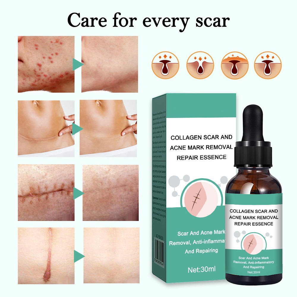 OEM Anti Inflammatory Collagen Scar and Acne Mark Removal Repair Essence Factory