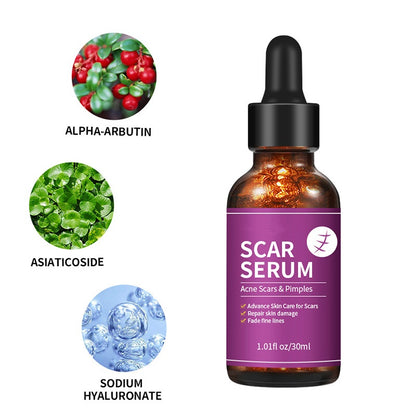OEM Advanced Skin Care Scar Pimples Removal Serum, Treatment for Acne Scars, Stretch Marks, and Dark Spots
