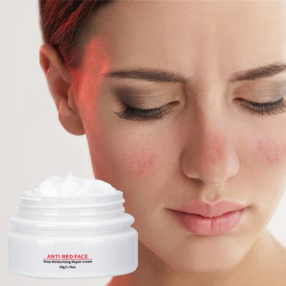 Popular Red Skin Relief Sunburn Soothing Sensitive Skin Calming Anti Redness Face Cream