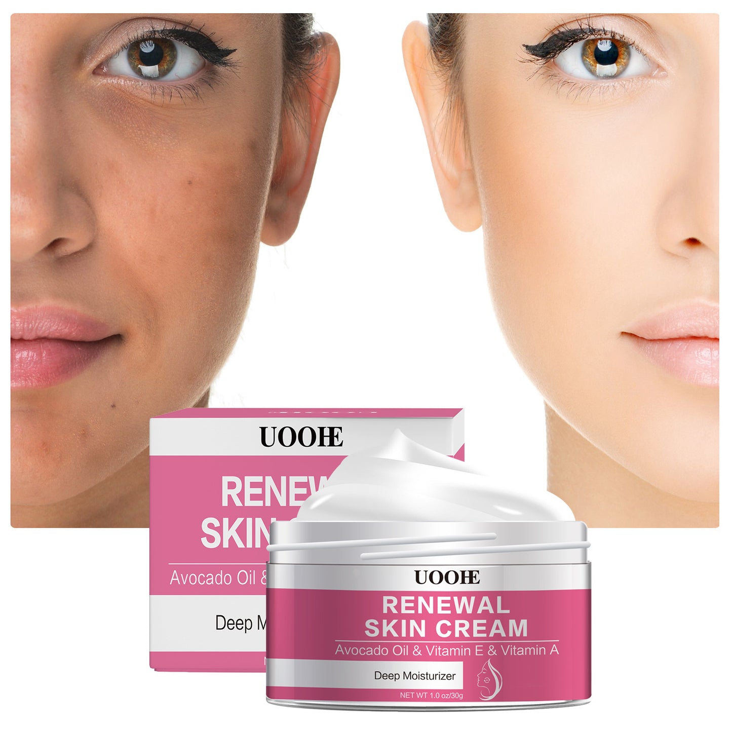 Hydrating Skin Smoothing Fine Lines Renewal Skin Cream 30g