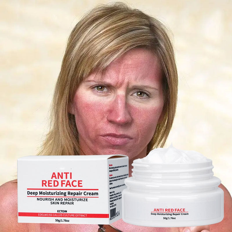 Popular Red Skin Relief Sunburn Soothing Sensitive Skin Calming Anti Redness Face Cream