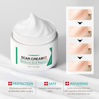 Hot Selling Skin Care Strong Effective Acne Scar Removal Cream Pimples Stretch Marks Remover Face Gel Stretch Mark Removal Cream