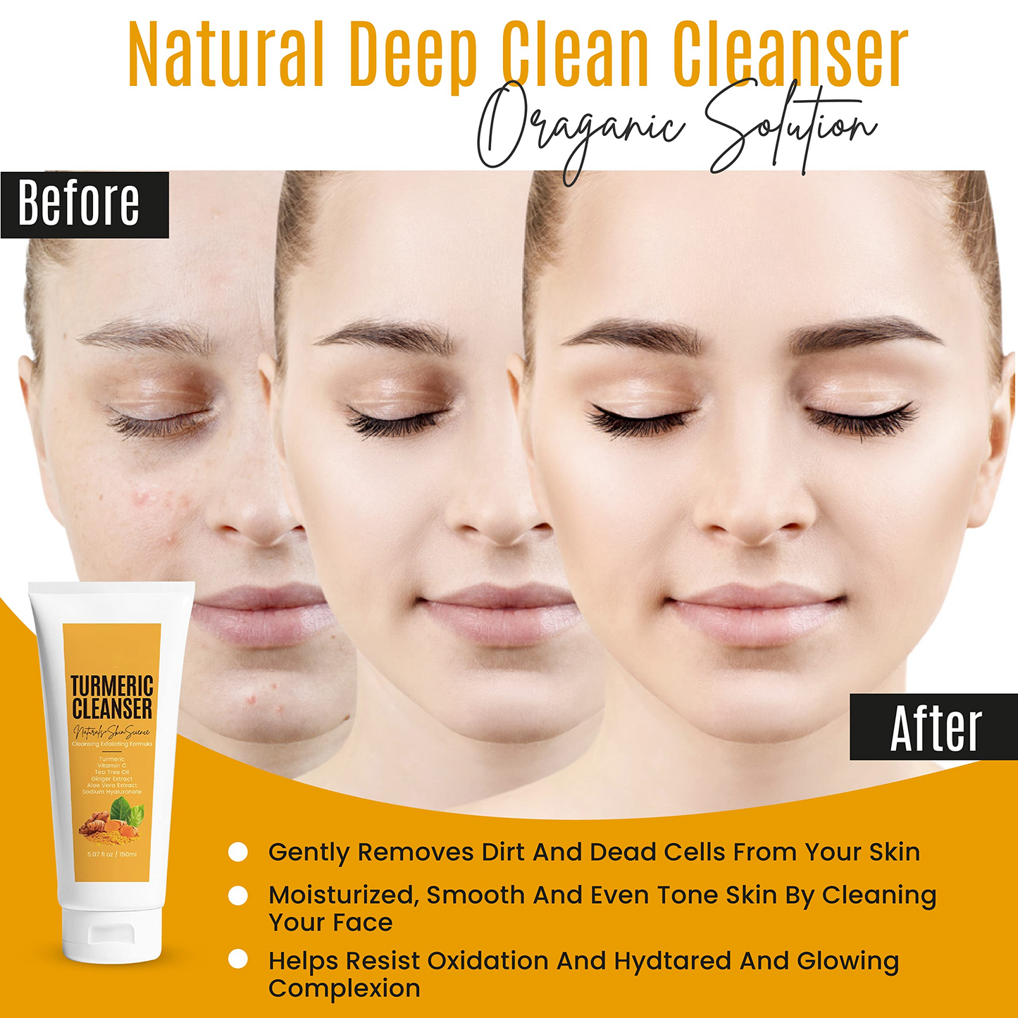 OEM Facial Foaming Acne Pimple Dark Spot Removal Deep Cleaning Face Wash Kojic Acid Turmeric vitamin c Facial Cleanser