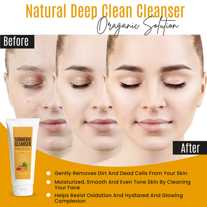 OEM Facial Foaming Acne Pimple Dark Spot Removal Deep Cleaning Face Wash Kojic Acid Turmeric vitamin c Facial Cleanser