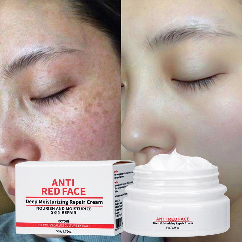 Popular Red Skin Relief Sunburn Soothing Sensitive Skin Calming Anti Redness Face Cream