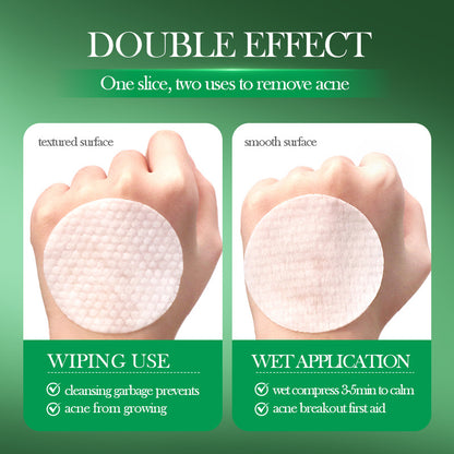 OEM Exfoliating Acne Treatment Salicylic Acid Pads for Acne & Blemishes Clear