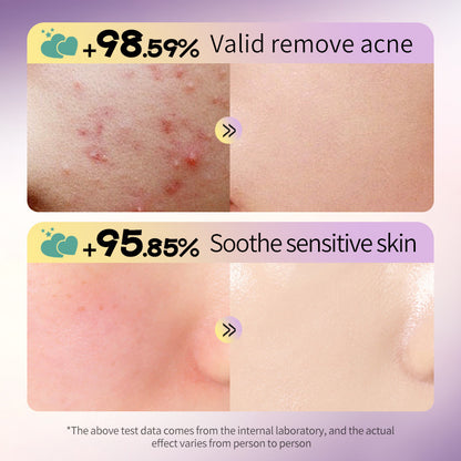 OEM Pimple Patches for Face, Hydrocolloid Acne Patches with Tea Tree, Salicylic Acid