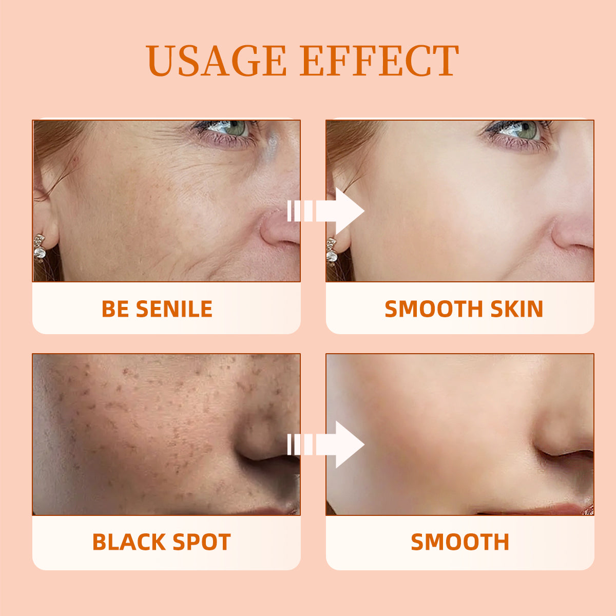 Hot Selling Organic Removal Pigment Dark Spot Moisturizing Repairing Anti-Aging Carrot Whitening Face Skin Care Cream