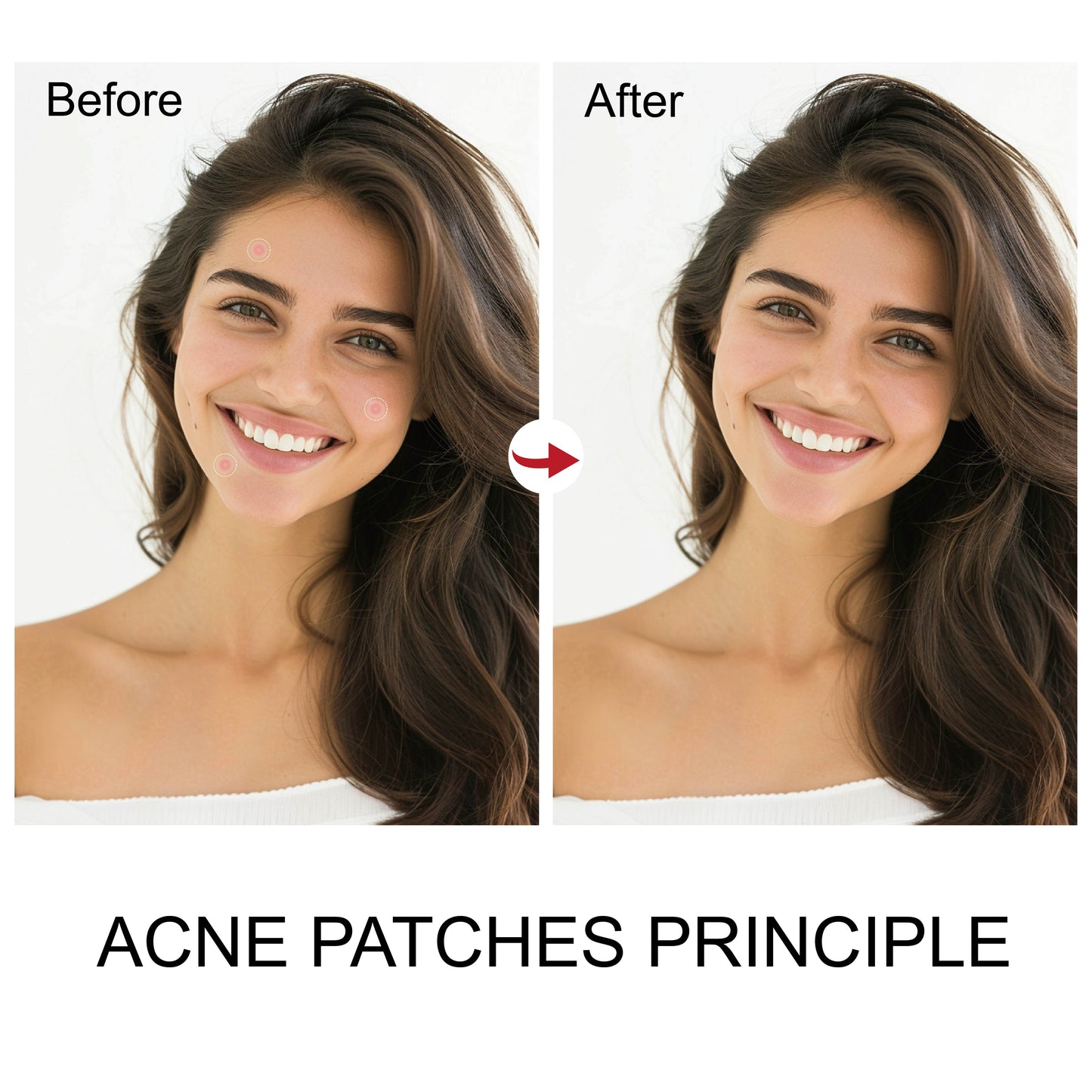 Best Mighty Patch to Remove Dark Spots on Face Waterproof Dark Spot Patches Tea Tree Oil Skin Care Spot Dots Treatment 36 Dots