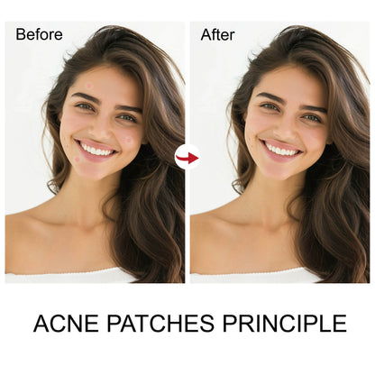 Best Mighty Patch to Remove Dark Spots on Face Waterproof Dark Spot Patches Tea Tree Oil Skin Care Spot Dots Treatment 36 Dots