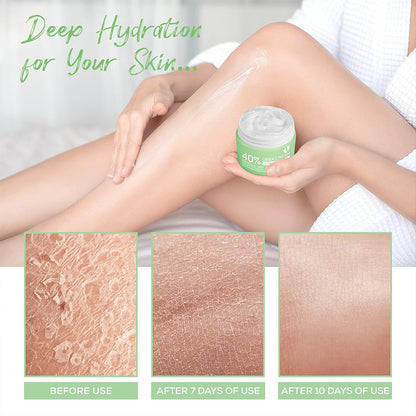 OEM Exfoliating Moisturizing Nourishing Hand Foot 45% Urea Cream For Rough Thick Dry Cracked Skin